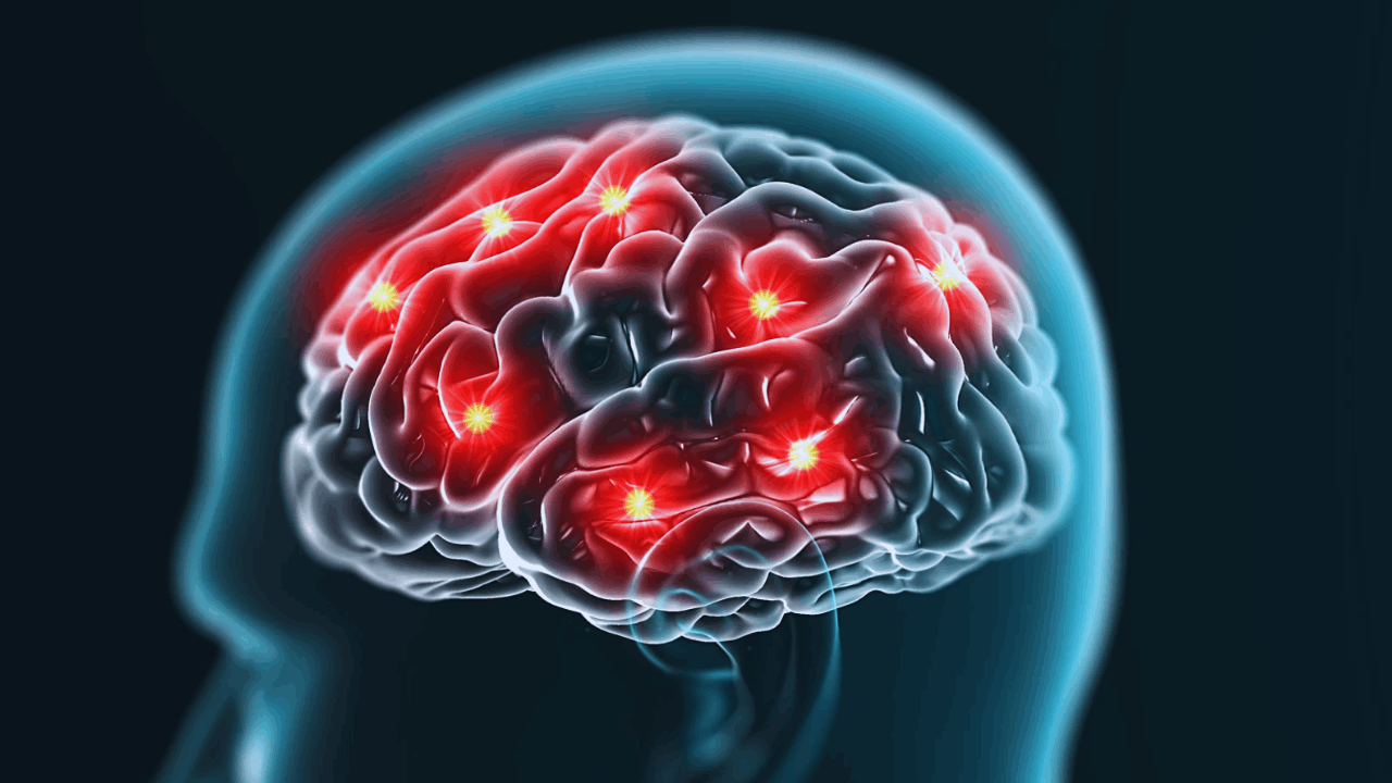 Memory Improvement Techniques That Actually Work